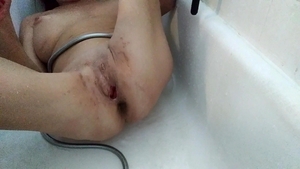Lizzy Yum - Lizzy Yum Post Op love tunnel And Verification